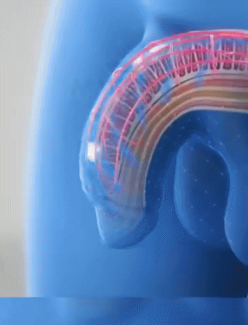 The Vibration Ring | Nooit Meer teleurstelling